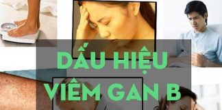 Dấu hiệu bệnh viêm gan B