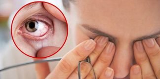 Tình trạng khô mắt là phổ biến mà nhiều người gặp phải