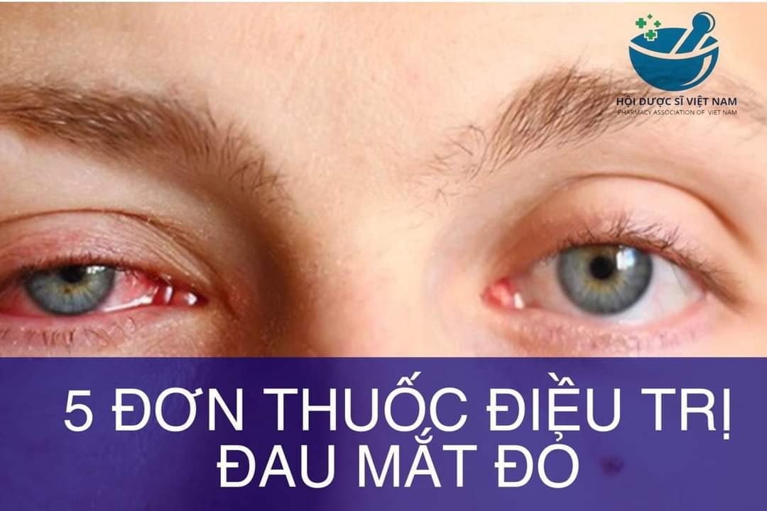 don-thuoc-tri-dau-mat-do