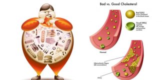 roi-loan-lipid-mau-1